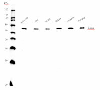 RPSA | 30S ribosomal protein S1 (bacterial) in the group Antibodies Other Species / Bacteria at Agrisera AB (Antibodies for research) (AS19 4305)